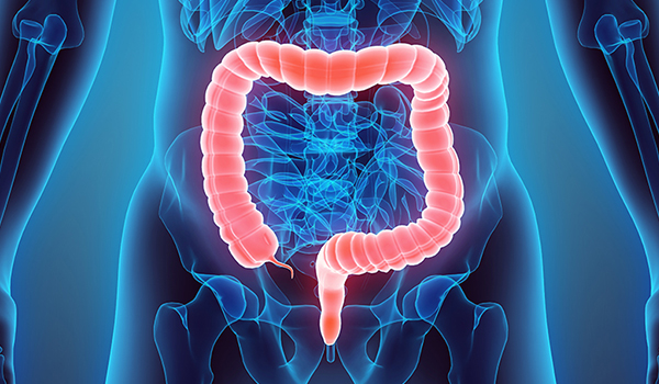 CIRUGÍA INTESTINAL