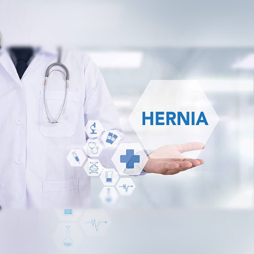 Precio de cirugía de hernia abdominal